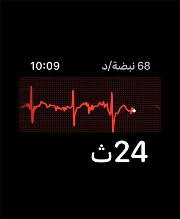 تطبيق تخطيط القلب، عدد النبضات في الدقيقة في الزاوية العلوية اليمنى، خط النَّظْم.، المؤقت