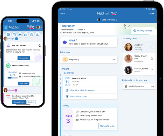 Un iPhone e un iPad che mostrano l’app MyChart di Epic.